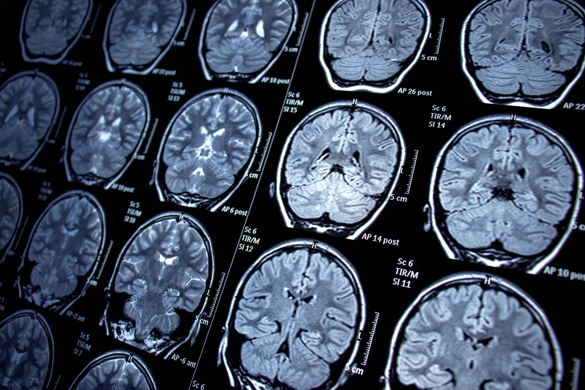 Нейробиолог развенчал главный миф о мозге